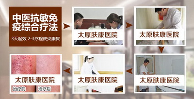 皮炎患者怎么治比较好